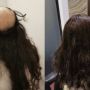 Hair Replacement System Singapore Cost