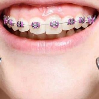 Orthodontics