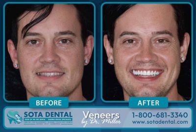 SOTA Dental is a multilingual team specializing in dental implants and All-on-4 procedures. We have surgical teams in Cancun, Playa del Carmen, Los Algodones, &amp; Tijuana. We also have four teams in Zagreb, Split, &amp; Dubrovnik.Our international doctors and US-Mexico-Croatia partnered management are providing the most innovative solutions for international patients seeking dental implants &amp; All-on-4 dentures in Mexico &amp; Croatia. SOTA Dental's doctors are blazing new paths in their respective fields, and their cases are shared and discussed on popular world-wide dental platforms.  https://sotadental.com/croatia