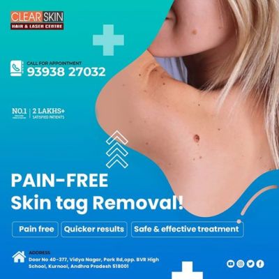 Find relief from skin allergies with the specialized care of a Skin Allergy Doctor in Kurnool at Clear Skin Hair and Laser Center. Our dedicated team ensures effective solutions for a comfortable and healthy skin experience.